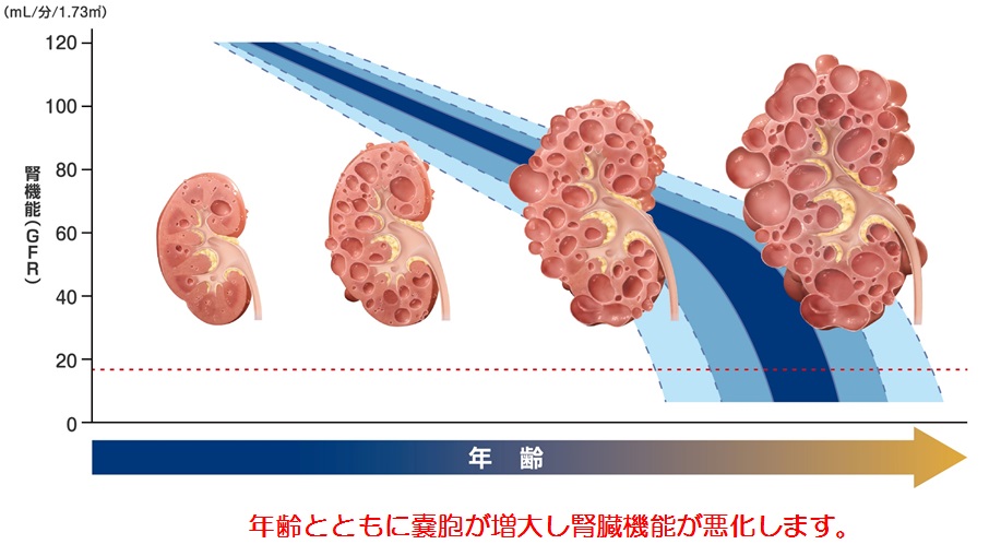 扁桃 腺 腎臓